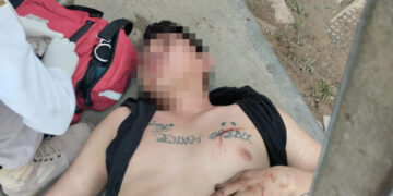 Motociclistas agreden a joven