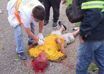 Motociclista se impacta contra un árbol
