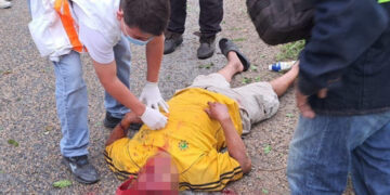 Motociclista se impacta contra un árbol