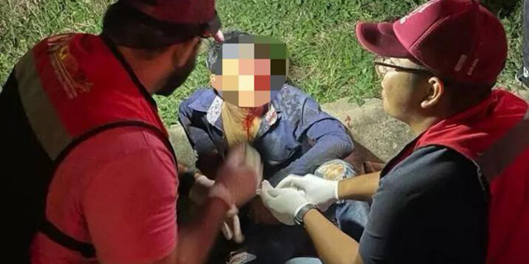 Quedó guapo del porrazo