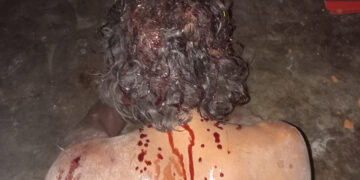 Casi linchan a uno y detienen a ladrona