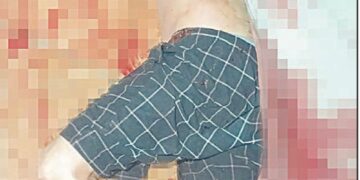 Le destaparon los sesos y aún vive