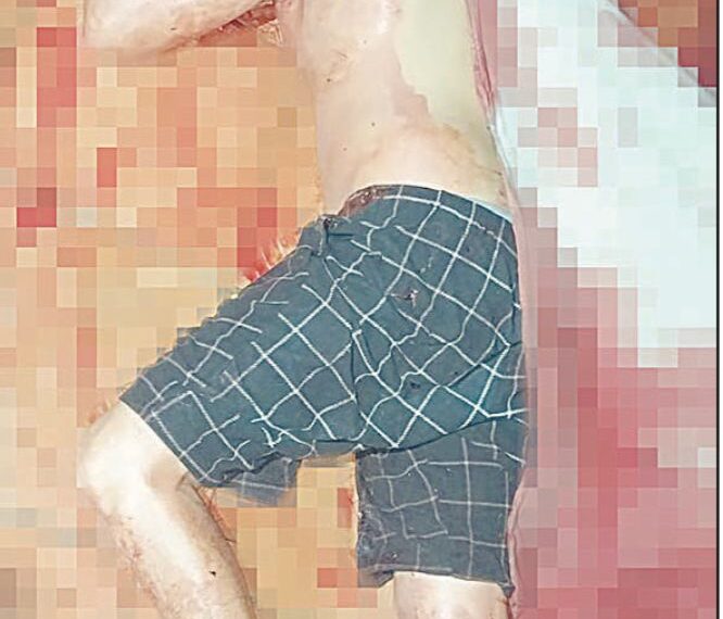 Le destaparon los sesos y aún vive