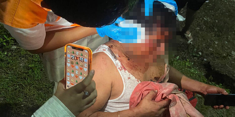 Lesionado con arma blanca