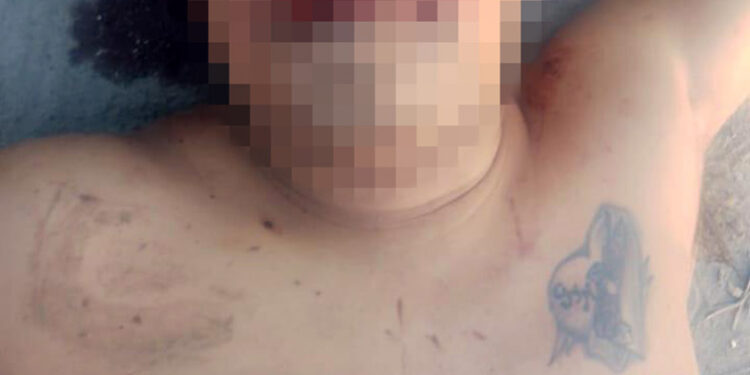 Le cercenaron las orejas y lo mataron