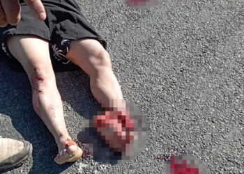 Mujer fallece tras accidente