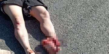 Mujer fallece tras accidente