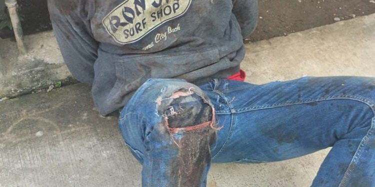 Cubano asesinó a su ex pareja